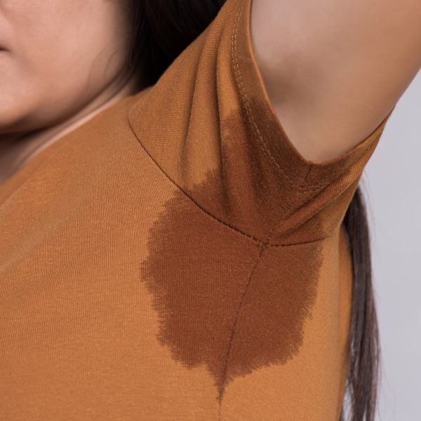 Tips to manage excessive sweating with PCOS