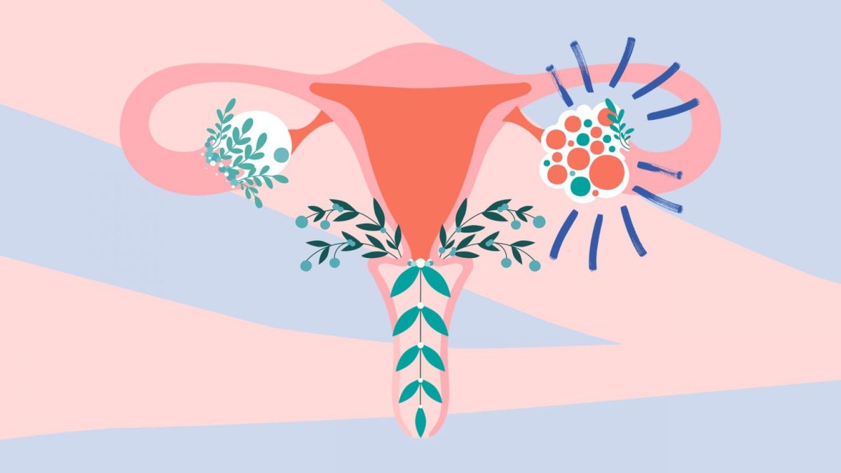 Busting Common PCOS Myths - Healthwatch by Shyft